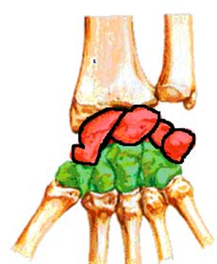 ossos da mão e dor no punho